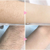 SmoothSpray™ | Snelle en perfect ontharen!